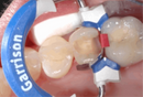 Composi-Tight® 3D Fusion™ Full Curve Matrix Bands