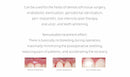 Laser LX16. A New Generation of High Power Dental Diode Laser - Dentsupply SIA