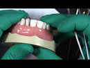 Garrison Fusion™ Anterior Matrix Bands