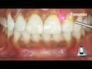 Laser LX16 Plus. Kolme lainepikkusega sinine pooljuhtlaserteraapia seade