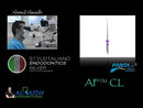 AF MAX Rotary File, 3pcs/box Single Size, Wing Box