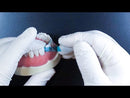 Blue View VariStrip Anterior Matrices Video tutorial