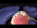 Garrison Fusion™ Anterior Matrix Bands
