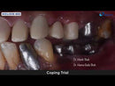 Helios 600 Dental Intraoral Scanner från Eighteeth