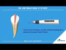 Fast-Pack Pro pour système d'obturation 3D Eighteeth