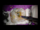 Ultrasonic Dental Scaler UltraMint Pro Scaling | Perio | Endo | Eighteeth