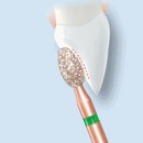 Komet diamantforberedelsesinstrument, DIAO - KP6379/KP6379E