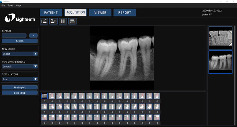 NanoPix Intraoral Digital Imaging Sensor