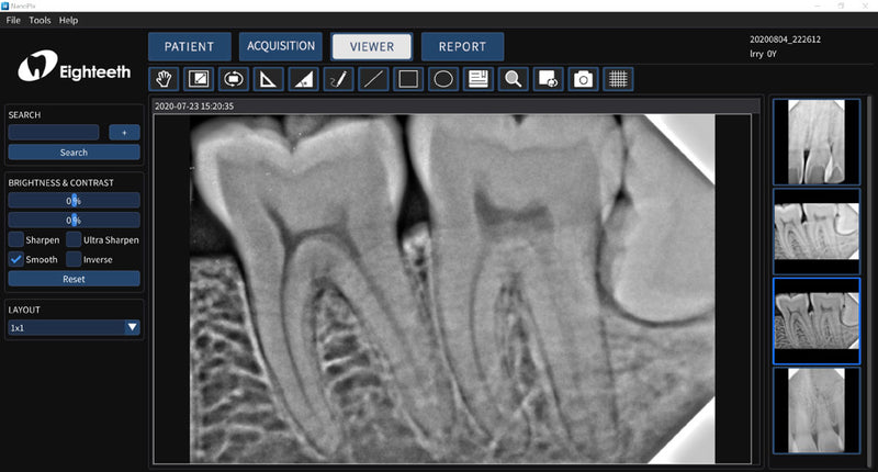 NanoPix Intraoral Digital Imaging Sensor