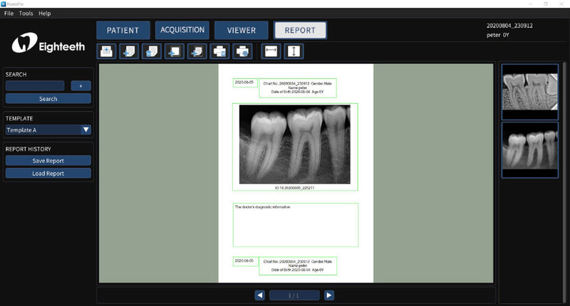 NanoPix Intraoral Digital Imaging Sensor