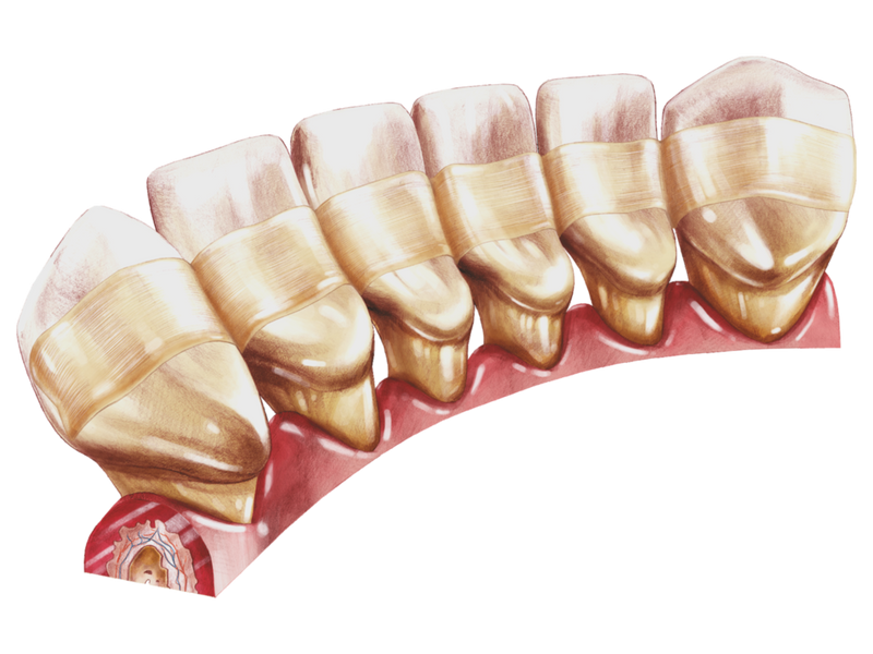 Arkona Comcord Dental Fibres