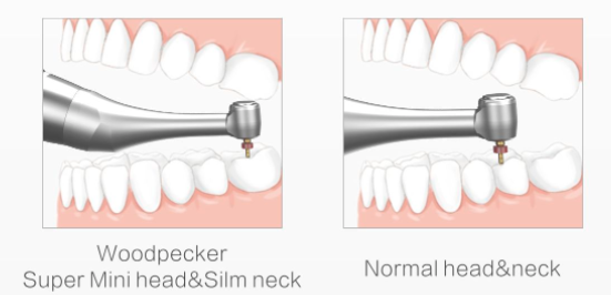 COMBO: Ai Endo Motor with Built in Apex Locator and T-Mode + Ultrasonic Endo Activator Endo 3