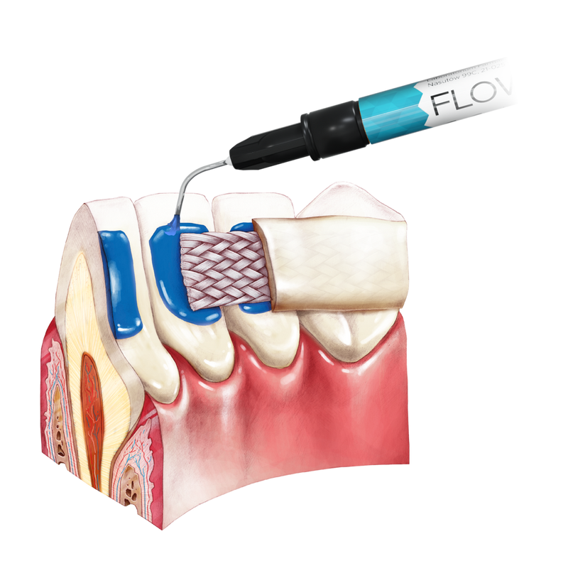 FLOW-COLOR colorful composite | ARKONA