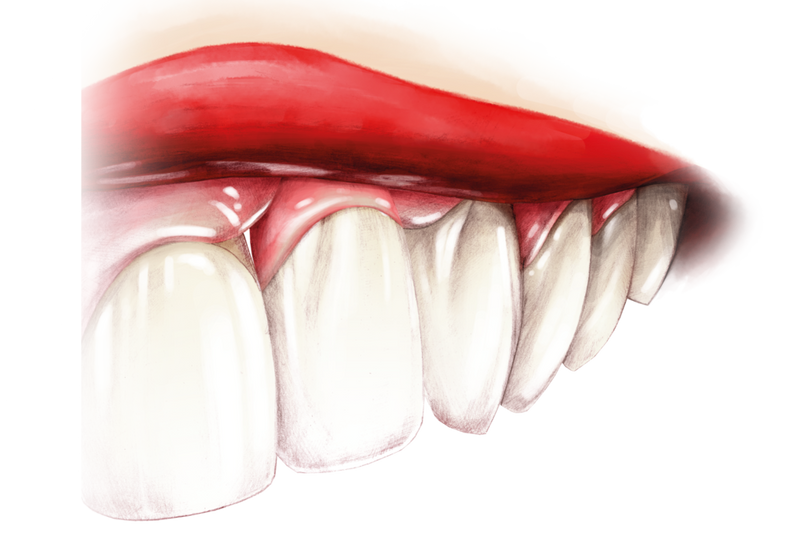 FLOW-COLOR colorful composite | ARKONA