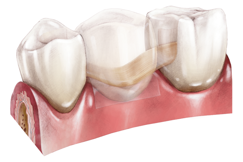 Arkona Comcord Dental Fibres