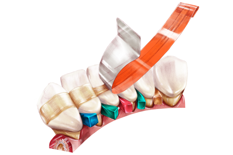 Arkona Comcord Dental Fibres