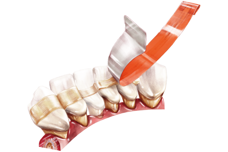 Arkona Comcord Dental Fibres