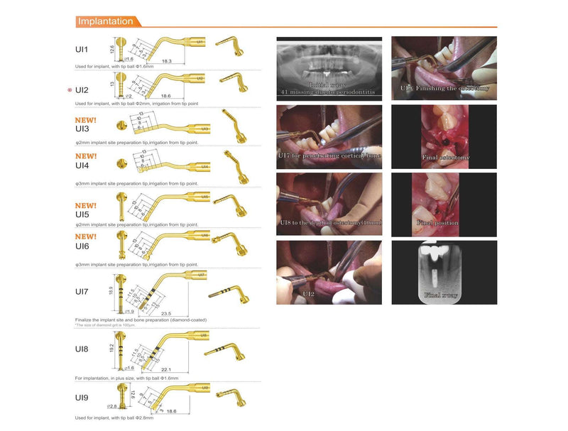 Woodpecker surgic-touch, piezo for bone surgery, endodontic, periodontic, bone function