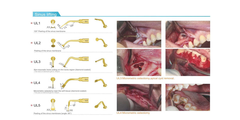 Woodpecker surgic-touch, piezo for bone surgery, endodontic, periodontic, bone function