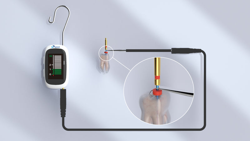 Localisateur d'apex E-Pex Pro de Eighteeth