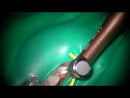 Root canal preparation to MTA obturation with Ai motor T-mode