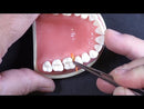  Interproximal Wedge RefillsComposi-Tight® 3D Fusion™ Wedge Placement