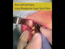 Woodpecker surgic-touch, piezo for bone surgery, endodontic, periodontic, bone function