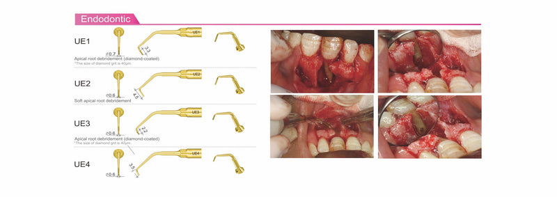 Woodpecker surgic-touch, piezo for bone surgery, endodontic, periodontic, bone function