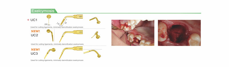 Woodpecker surgic-touch, piezo for bone surgery, endodontic, periodontic, bone function